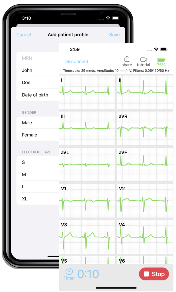 SmartMedics EKG - aplikacja