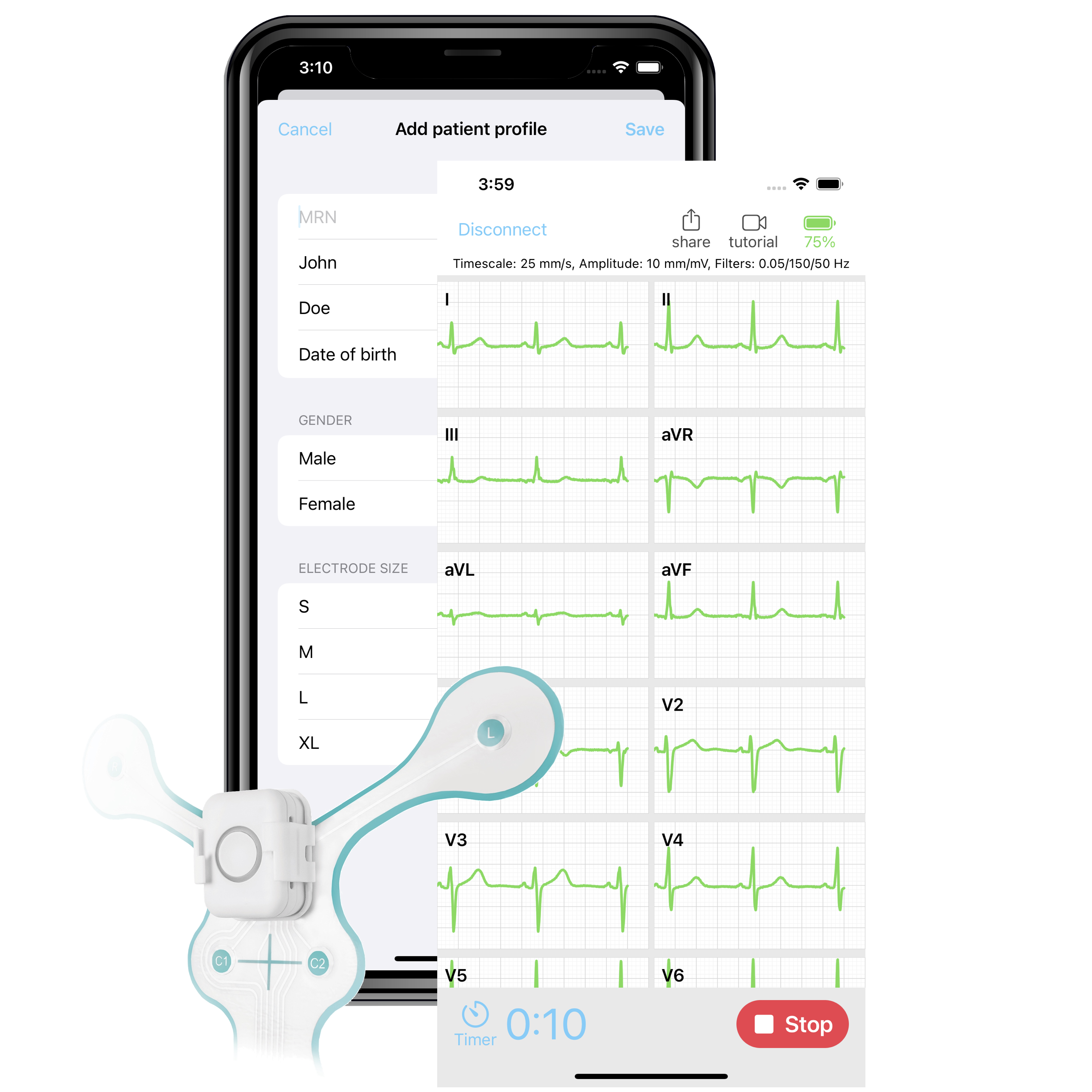 SmartMedics ECG